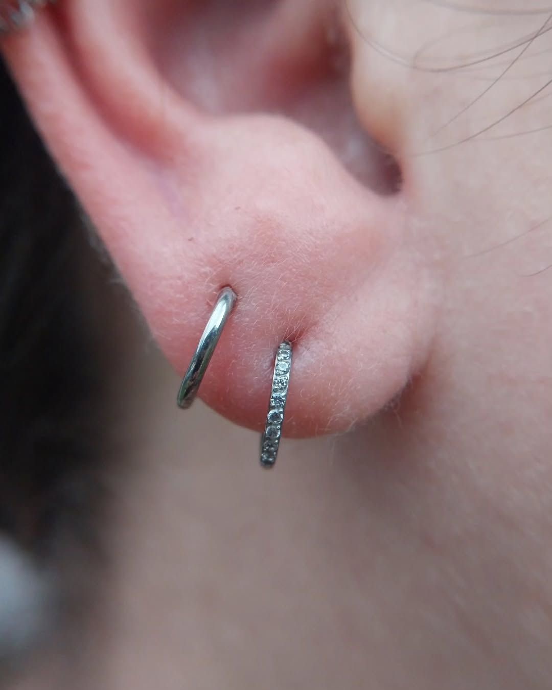 Múltiples perforaciones en el lóbulo